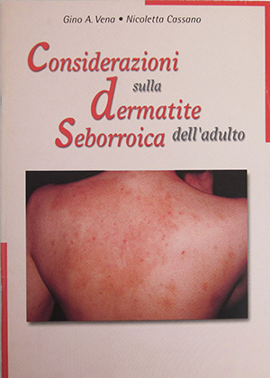 Considerazioni sulla Dermatite Seborroica